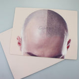2pcs Male and Female Scalp Micropigmentation Practice Skin for Thinning Hair Tattoo and Hair Density Practice Pad (Mix)