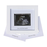 IHEIPYE Baby Sonogram Photo Frame Ultrasound Picture Frame White
