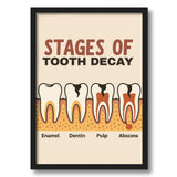 Artaction Dental Poster Wall Frame | Enamel, Dentin, Pulp, Abscess A4 Size Framed Poster For Dental Clinics, Living Room, Office
