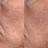Collagen Cream Moisturizer