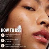 Acne Treatment Dots