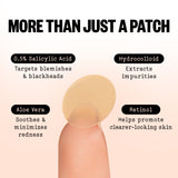 Acne Treatment Dots