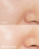Biome Boost Cream Daily Moisturizer
