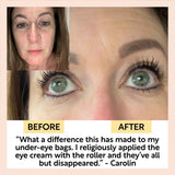 The Caffeinated Duo + Eye Roller Deal