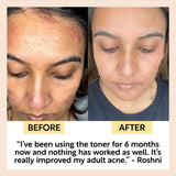 Face Toner with Hyaluronic Acid - Travel Size