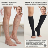 Nylon Open-Toe Compression Socks