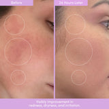 THIRST TRAP Barrier Repair Cream + SPF Ultra-Hydration Bundle