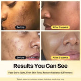 Superactive Serum