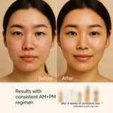 Full-Size Korean Skincare Set for Dark Spots, Fine Lines & Glass Skin