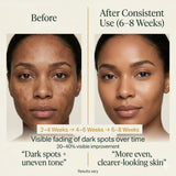 Daily Glow Routine Bundle (Cleanse + Treat + Moisturize)