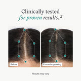 Nutrafol Women's Hair Growth for Thicker, Stronger Hair 3-Month Supply