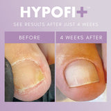 The GelBottle - HypoFix Primer, 20ml