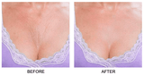 Chest Wrinkle Patch | Reusable Skin Plumping Chest Mask