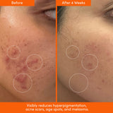 THE PLACENTA FACIAL Dark Spot Serum + Barrier Repair Cream Bundle