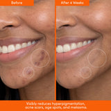 THE PLACENTA FACIAL Dark Spot Serum + Barrier Repair Cream Bundle