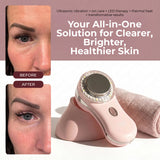 MYSKINBUDDY® 30-Day Reset System