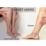 Open-Toe Knee-High Compression Socks, 20-30 mmHg