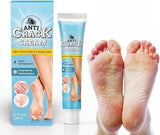 Moisturizing Foot Cream 20g Softening Heel Balm for Dry, Rough & Hard Skin Daily Foot Care (1)
