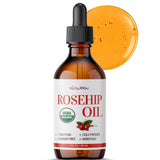 BodyJ4You Rosehip Oil for Face - 100% Pure Natural USDA Organic Cold Pressed - Hydrating Skin Hair Nails Anti-Aging Wrinkle Scar