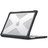 Fintie Case for MacBook Pro 14 Inch A3401 A3185 A3112 A2992 A2918 A2779 A2442 with M4 M3 M2 M1 Chip (2024 2023 2022 2021 Release