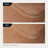 Revision Skincare Nectifirm Advanced, Anti Aging Neck Firming Cream with Peptides for Fine Lines, Wrinkles and Crepey Skin, 1.7