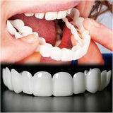 2 Pairs, Top and Bottom, Temporary Nature and Comfortable to Regain Confident Smile,(White)