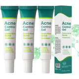 Azelaic Acid Serum for Face Acne Treatment, Body Acne Clearing Treatment with 10% Azelaic Acid & Salicylic Acid, Sensitive Skin 