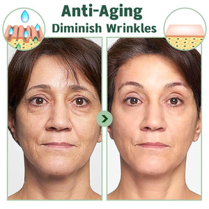 zhnnt 40 Pack Collagen Firming Face Mask,Wash-Free Firming Anti-Ageing Moisturising Face Mask,Smooth & Tight Skin,Facial Masks F