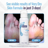 Footlogix Very Dry Skin Formula 3