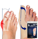 Bunion Corrector for Women Big Toe Spacer. Ultra Thin Brace for Inside Any Shoes. Great Toes Straightener & Correction Socks. So