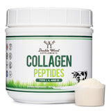 Collagen Peptides Powder - Hydrolyzed Collagen, Keto Safe - 16.08oz - Multi Type 1, 2, and 3 (Grass Fed Bovine Source)(Colageno 