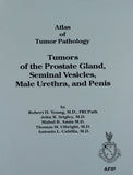 Tumors of the Prostate, Seminal Vesicles, Male Urethra and Penis: 28