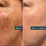 Retinol Plus Vitamin C Skin Refining Night Oil