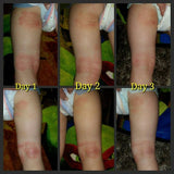 Skin Rejuvenation Cream
