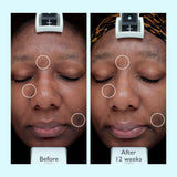 Restorsea PRO Intensive Treatment 10x Face Serum