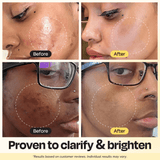 Vitamin C Clay Mask