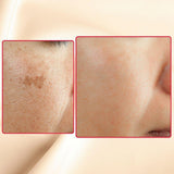 The Eraser Spot Cream | Dark Spot Correcting Moisturizer