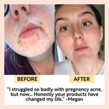 Hydration Skincare Set