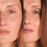 Biocellulose Youth-Restoring Face & Neck Mask