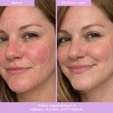 THE PLACENTA FACIAL Dark Spot Serum + Barrier Repair Cream Bundle