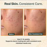 AMVital Turmeric Vitamin C Clay Mask