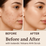 Icelandic Volcano AHA Face & Body Scrub