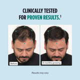 Nutrafol Men's Hair Growth Supplement 3-Month Supply
