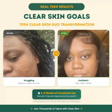 Teen Clear Skin Duo
